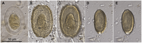 Eggs of parasitic nematodes isolated from coprolites of the giant New Zealand moas. (Images from Wood et al., 2013)
