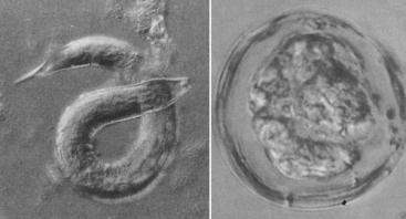 The nematode Strongyloides shastensis and coccidian Archeococcidia nothrotheriopsae once foraged in the digestive tracts of Shasta ground sloth. Their habitat disappeared at the end of the Pleistocene, and as a result they is now likely extinct. Images from Schmidt & Duszynski (1992).