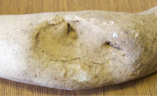 Hydrodamalis gigas rib collected on Bering island showing evidence of pathology. Likely the result of spearing with a 3-pronged harpoon that the individual recovered from. Image from Burdin 2012